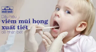 Dấu hiệu viêm mũi họng xuất tiết dễ nhận biết và cách điều trị hiệu quả