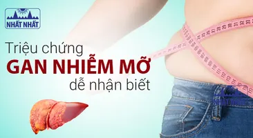 Những triệu chứng gan nhiễm mỡ điển hình, dễ nhận biết 