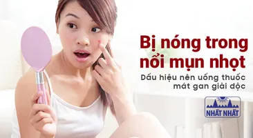Bị nóng trong, nổi mụn nhọt – Dấu hiệu nên uống thuốc mát gan giải độc