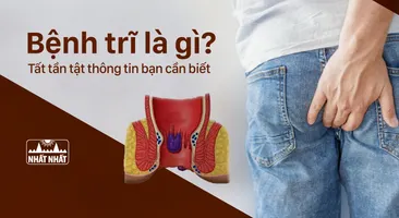Bệnh trĩ là gì? Tất tần tật thông tin bạn cần biết