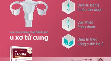 Lựa chọn phương pháp điều trị u xơ tử cung phù hợp