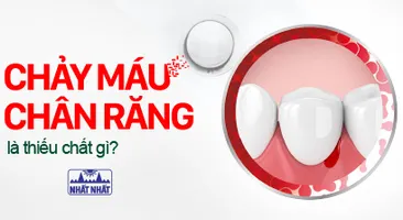 Chảy máu chân răng là thiếu chất gì, điều trị thế nào nhanh khỏi nhất?