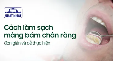 Cách làm sạch mảng bám chân răng đơn giản và dễ thực hiện