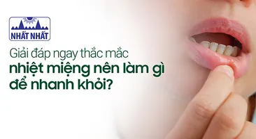 Giải đáp ngay thắc mắc nhiệt miệng nên làm gì để nhanh khỏi?