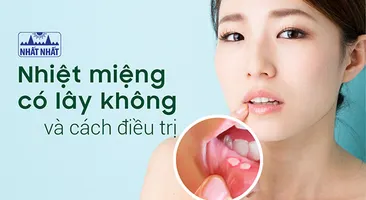 Nhiệt miệng có lây không và cách nào giúp vết loét nhanh lành?