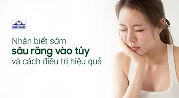 Nhận biết sớm sâu răng vào tủy và cách điều trị hiệu quả