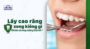 Lấy cao răng xong kiêng gì để bảo vệ răng miệng thật tốt?
