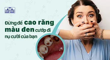 Đừng để cao răng màu đen cướp đi nụ cười của bạn!