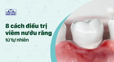 Tiết lộ ngay 8 cách điều trị viêm nướu răng từ tự nhiên