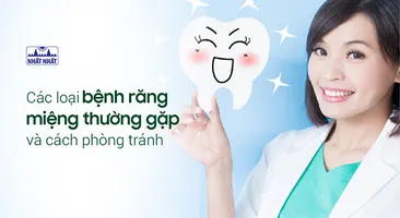 Các loại bệnh răng miệng thường gặp và cách phòng tránh