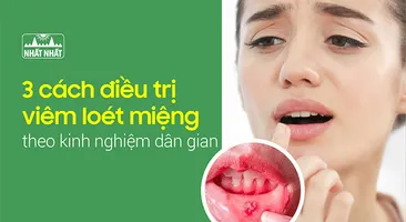 Mách nhỏ 3 cách điều trị viêm loét miệng theo kinh nghiệm dân gian