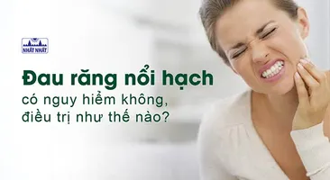 Đau răng nổi hạch có nguy hiểm không, điều trị như thế nào?