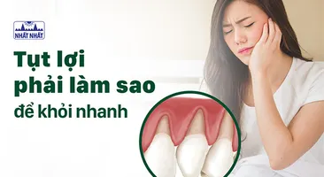 Tụt lợi phải làm sao để khỏi nhanh, bảo vệ răng miệng toàn diện?