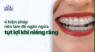 4 biện pháp nên làm để ngăn ngừa tụt lợi khi niềng răng