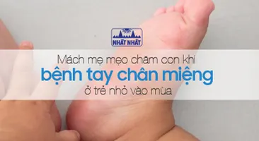 Mách mẹ mẹo chăm con khi bệnh tay chân miệng ở trẻ nhỏ vào mùa