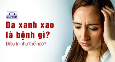 Da xanh xao là bệnh gì? Điều trị như thế nào?
