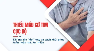 Thiếu máu cơ tim cục bộ – Khi trái tim “đói” oxy và cách khôi phục tuần hoàn máu tự nhiên