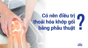 Điều trị thoái hóa khớp gối bằng phẫu thuật: Nên hay không?