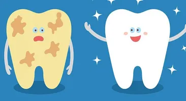 Cách loại bỏ mảng bám trên răng: đơn giản, nhanh chóng, dễ thực hiện