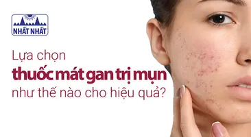 Lựa chọn thuốc mát gan trị mụn như thế nào cho hiệu quả?
