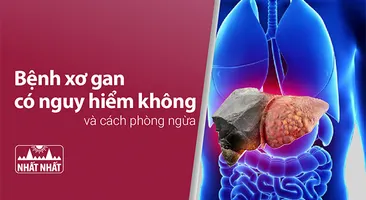 Giải đáp thắc mắc “Bệnh xơ gan có nguy hiểm không và cách phòng ngừa”