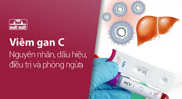 Viêm gan C – Nguyên nhân, dấu hiệu, điều trị và phòng ngừa