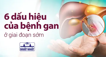 6 dấu hiệu của bệnh gan ở giai đoạn sớm giúp can thiệp kịp thời