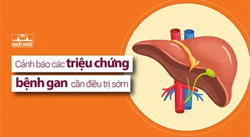 Cảnh báo các triệu chứng bệnh gan cần điều trị sớm