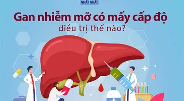 Gan nhiễm mỡ có mấy cấp độ, điều trị thế nào?