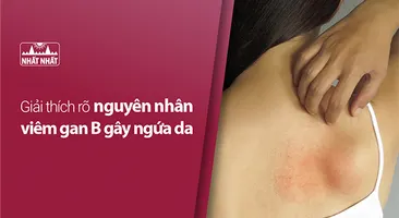 Giải thích rõ nguyên nhân viêm gan B gây ngứa da 