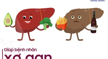 Giúp bệnh nhân xơ gan phục hồi sức khỏe