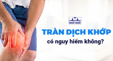 Giải đáp: Tràn dịch khớp có nguy hiểm không?