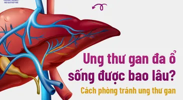 Ung thư gan đa ổ sống được bao lâu? Cách phòng tránh ung thư gan
