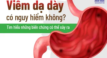 Viêm dạ dày có nguy hiểm không: Tìm hiểu những biến chứng có thể xảy ra