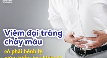 Viêm đại tràng chảy máu có phải bệnh lý nguy hiểm hay không?