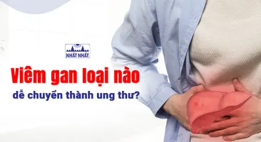 Tư vấn: Viêm gan loại nào dễ chuyển thành ung thư?