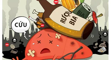 Dấu hiệu dễ nhận biết bệnh viêm gan do rượu