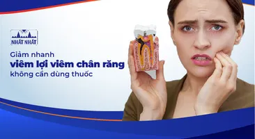 Giảm nhanh viêm lợi viêm chân răng không cần dùng thuốc