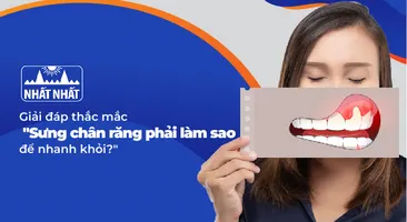 Giải đáp thắc mắc sưng chân răng phải làm sao để nhanh khỏi?