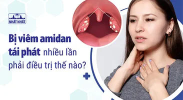 Bị viêm amidan tái phát nhiều lần phải điều trị thế nào?