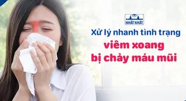 Xử lý nhanh tình trạng viêm xoang bị chảy máu mũi 