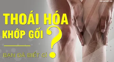 Tìm hiểu về thoái hóa khớp gối