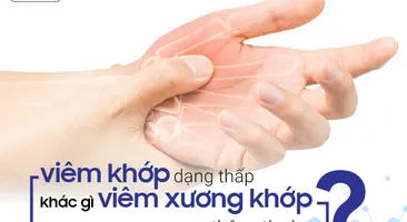 Viêm khớp dạng thấp khác gì viêm xương khớp thông thường?