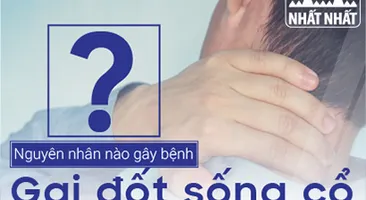 Nguyên nhân khiến người trẻ tuổi bị bệnh gai đốt sống cổ ngày càng nhiều