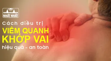 Các cách điều trị viêm quanh khớp vai hiệu quả - an toàn