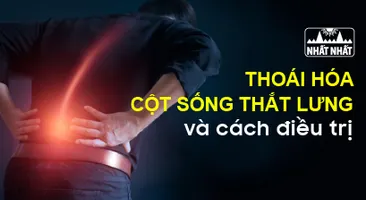 Thoái hóa cột sống thắt lưng: Nguyên nhân, triệu chứng và cách điều trị