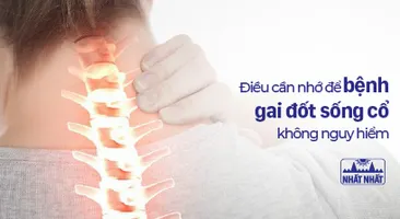 Những điều cần ghi nhớ để bệnh gai đốt sống cổ không gây nguy hiểm