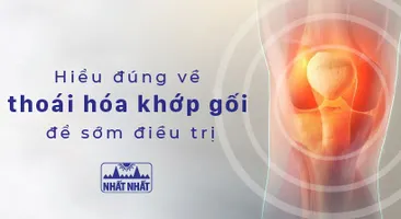 Hiểu đúng về thoái hóa khớp gối để có phương pháp điều trị thích hợp