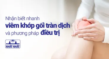 Nhận biết nhanh viêm khớp gối tràn dịch và phương pháp điều trị