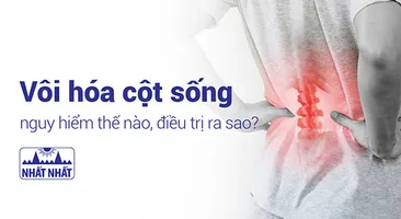 Vôi hóa cột sống nguy hiểm thế nào, điều trị ra sao?